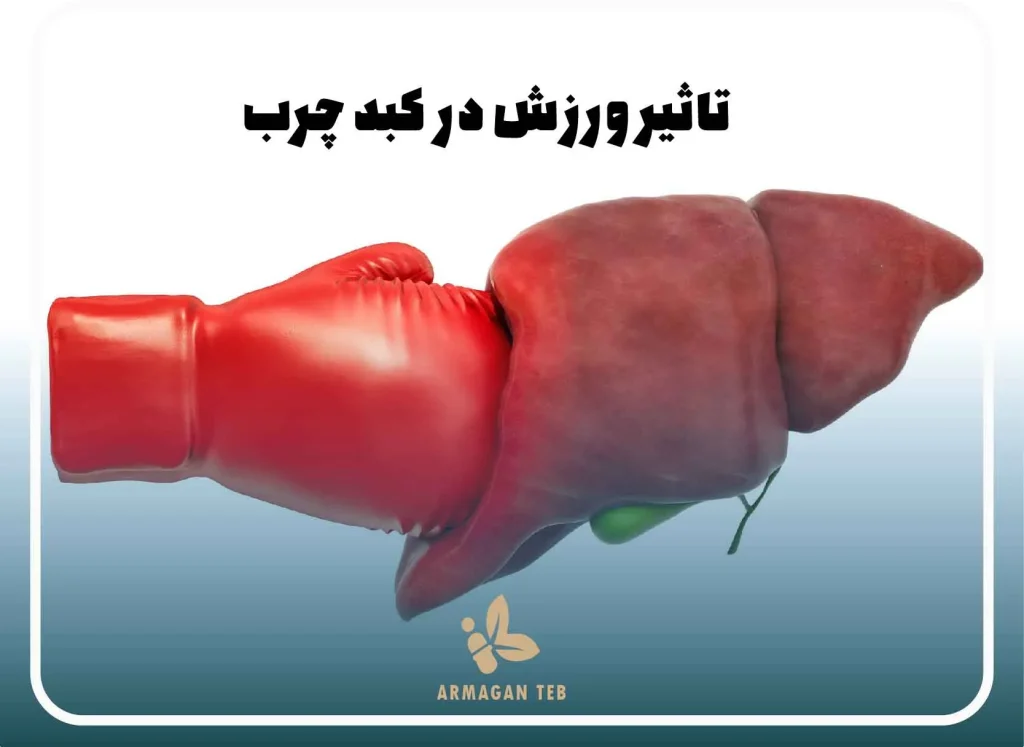 درمان کبد چرب در منزل 