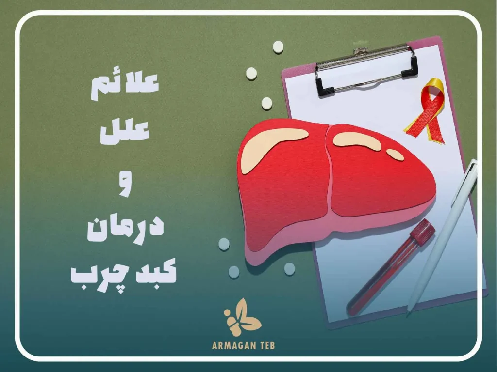 علائم کبد چرب