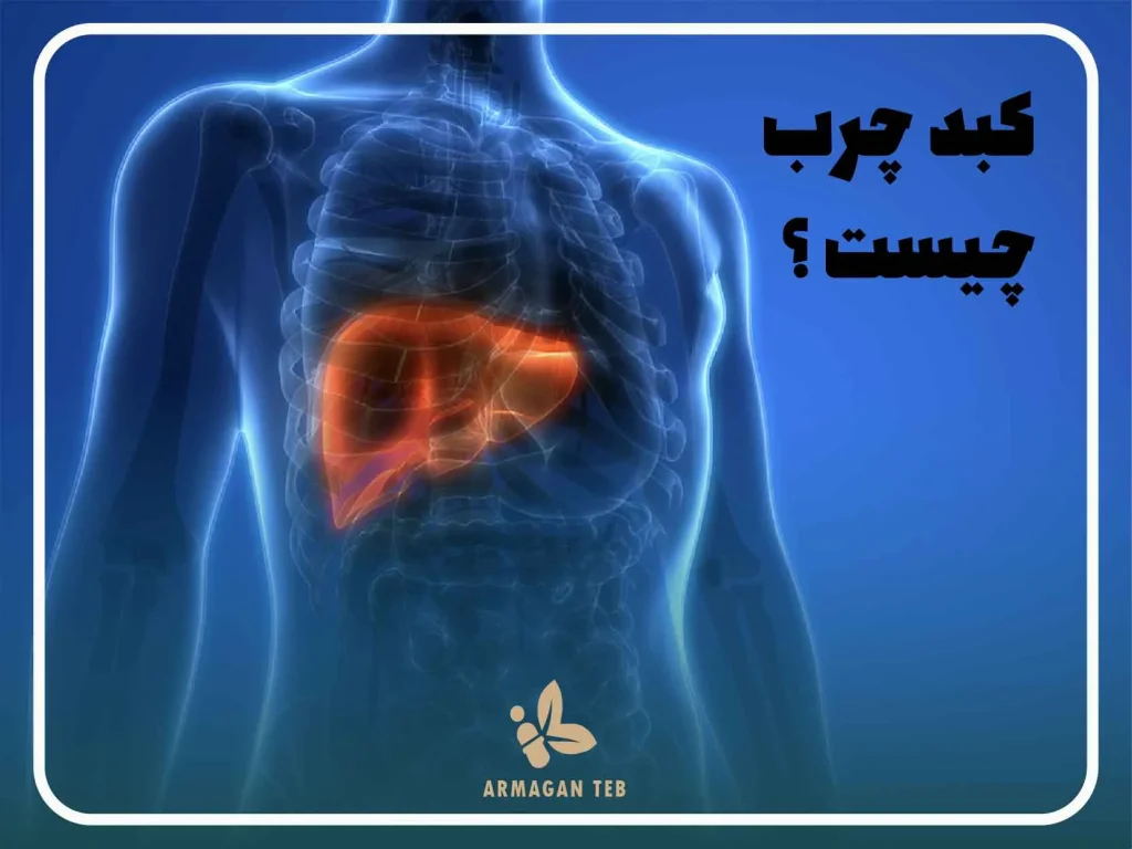 انواع گرید های کبد چرب و علائم و روش های تشخیص هرکدام