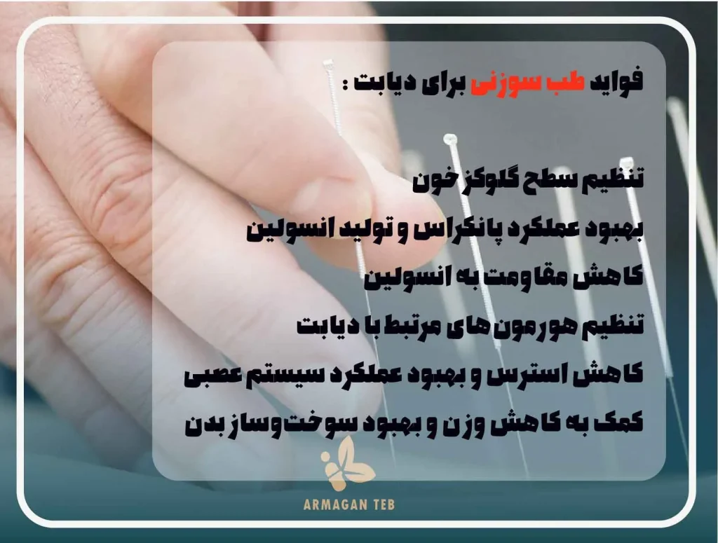 فواید طب سوزنی برای دیابت 