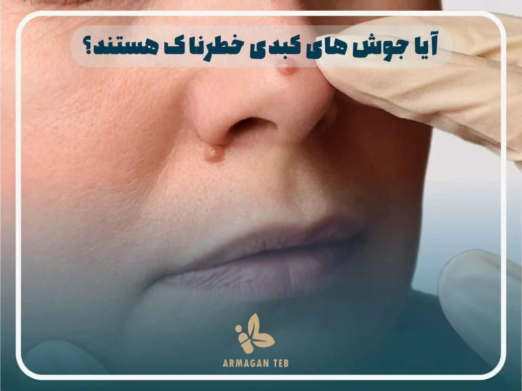آیا جوش های کبدی خطرناک هستند؟​